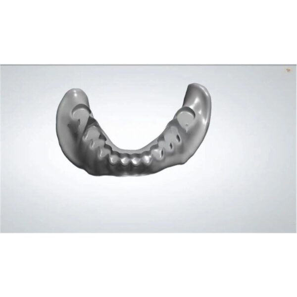 Professional acrylic denture design CAD workflow showing digital modeling process for full and partial dentures